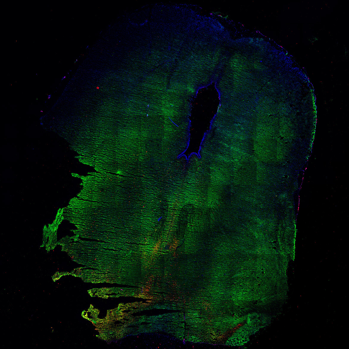 Human foetal midbrain